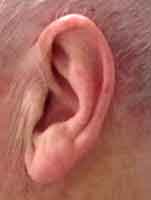 narrow connecting tube for behind-the-ear-hearing aid